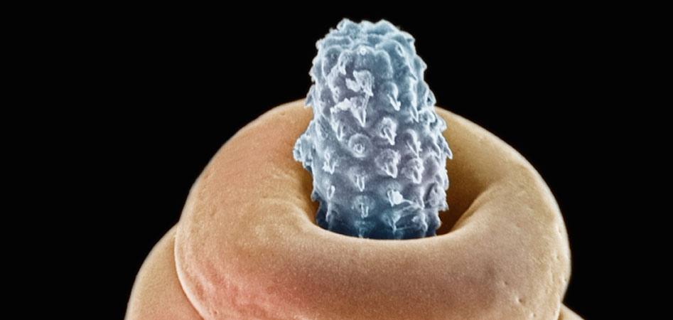 Worm Prosboscis