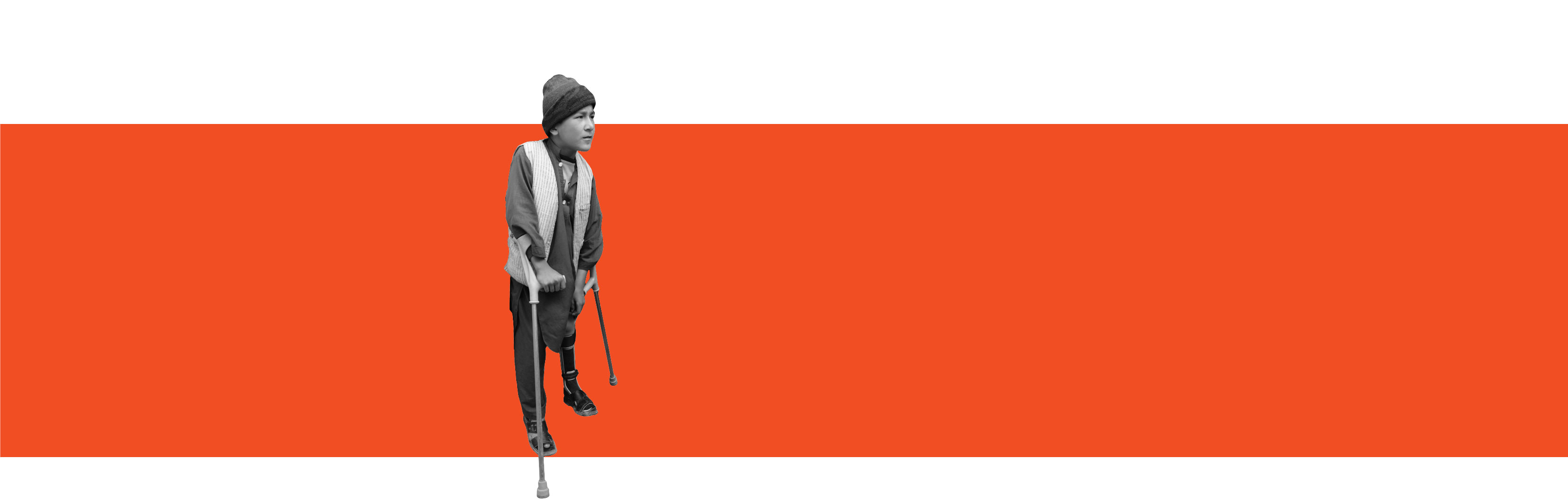 Photograph of a young man who had polio, with a prosthetic leg